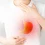Heartburn (Indigestion)